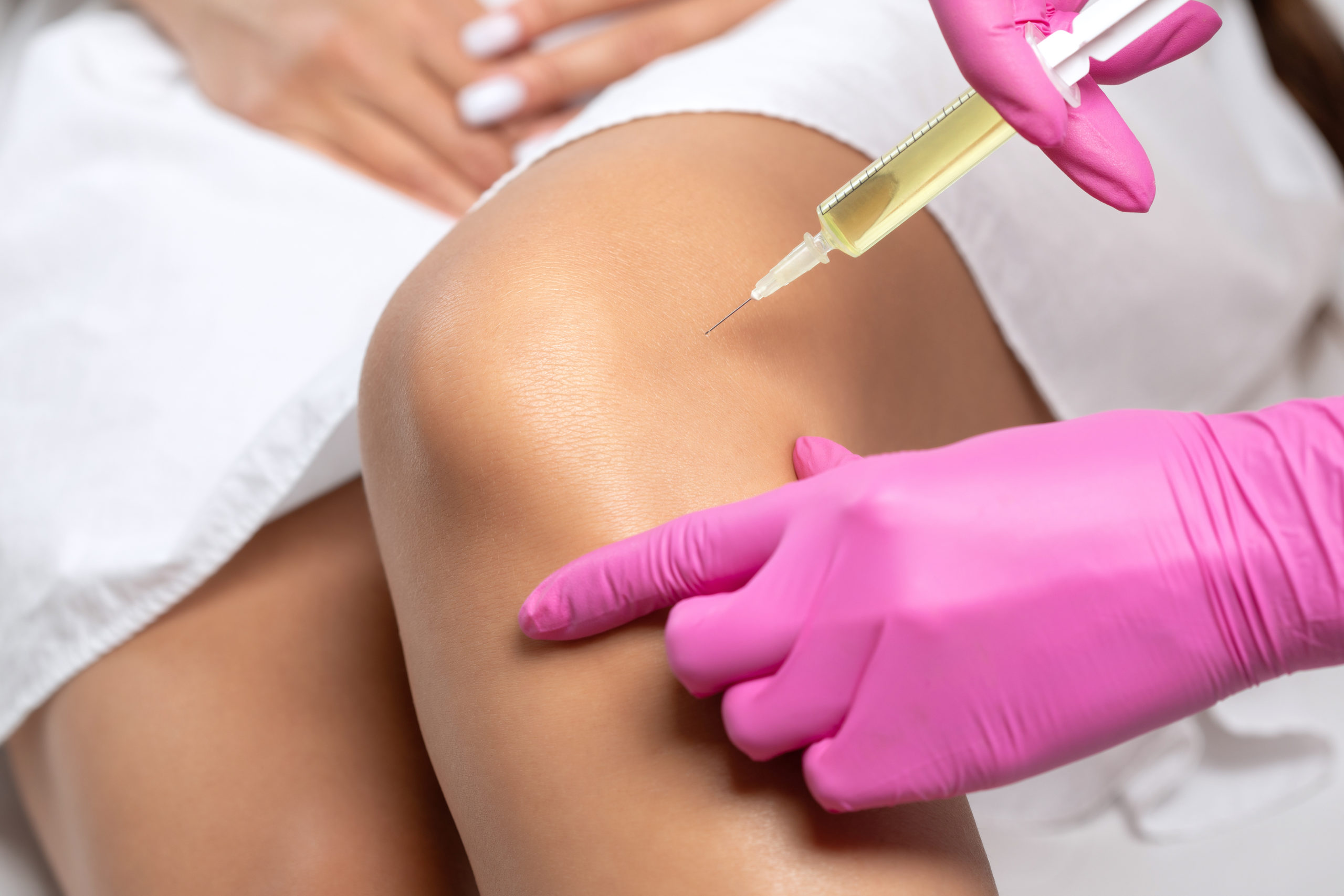 Doctor doing stem cell therapy on a patient's knee after the inj